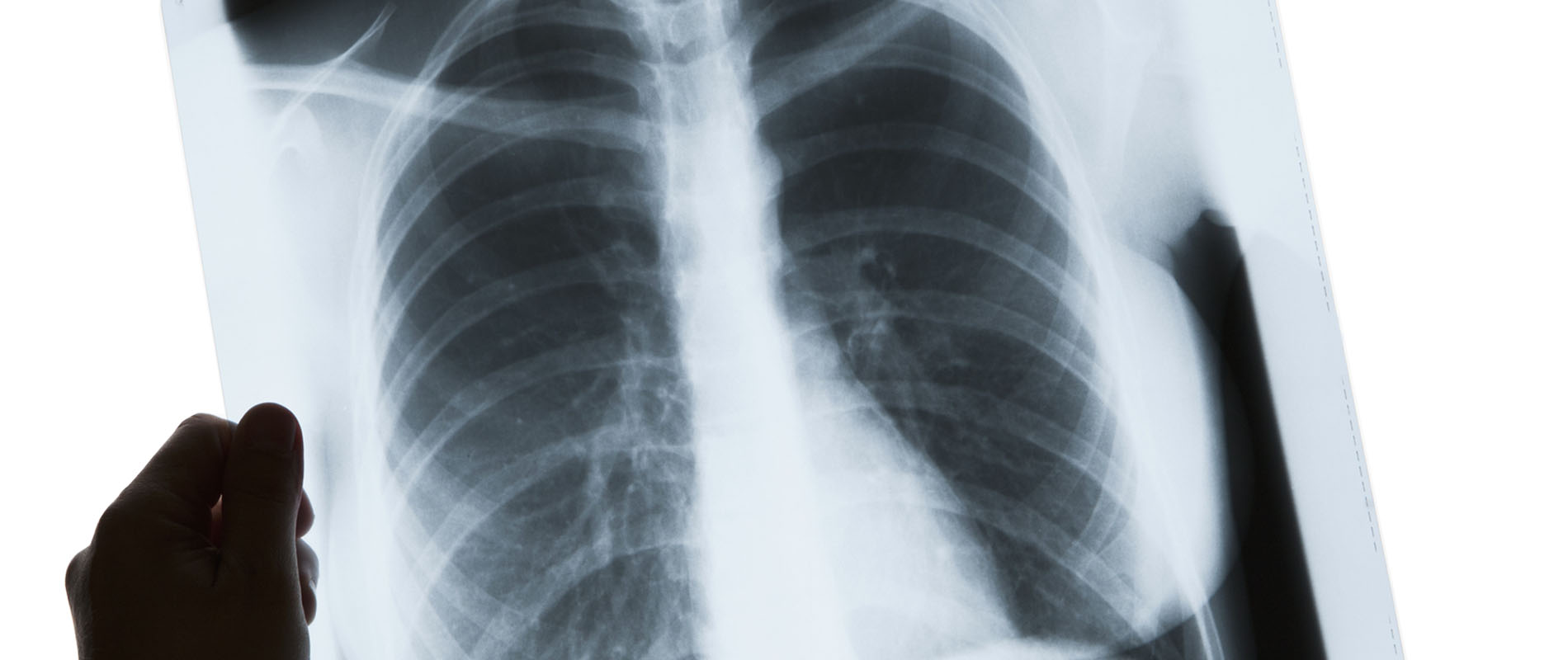 RTI Multi modalities X-ray